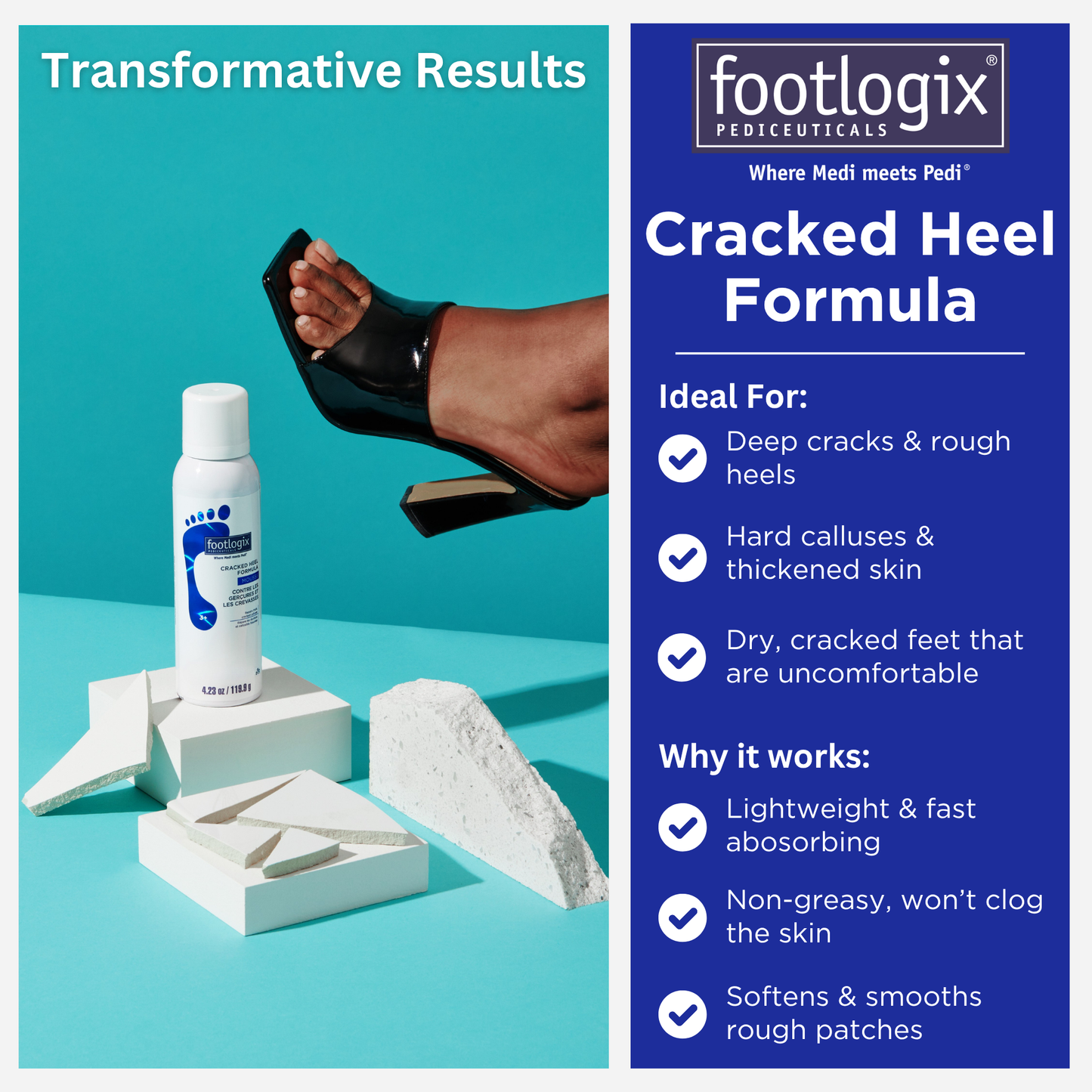 A bottle of Footlogix Cracked Heel Formula mousse on white geometric blocks, with a woman’s foot wearing a black high-heeled shoe in the background. The text on the right side reads, "Transformative Results," followed by "Cracked Heel Formula," and key product details, including "Ideal For" and "Why it works" sections, highlighting the product's benefits for cracked heels, calluses, and dry, uncomfortable feet.