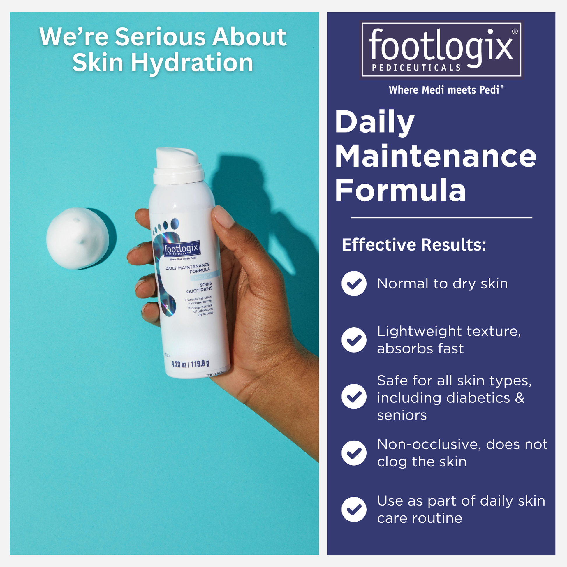 Hand holding Footlogix® Daily Maintenance Formula Mousse with a dollop of mousse shown beside it. Text lists key benefits: suitable for normal to dry skin, lightweight and fast-absorbing texture, non-clogging formula, and safe for all skin types including diabetics and seniors