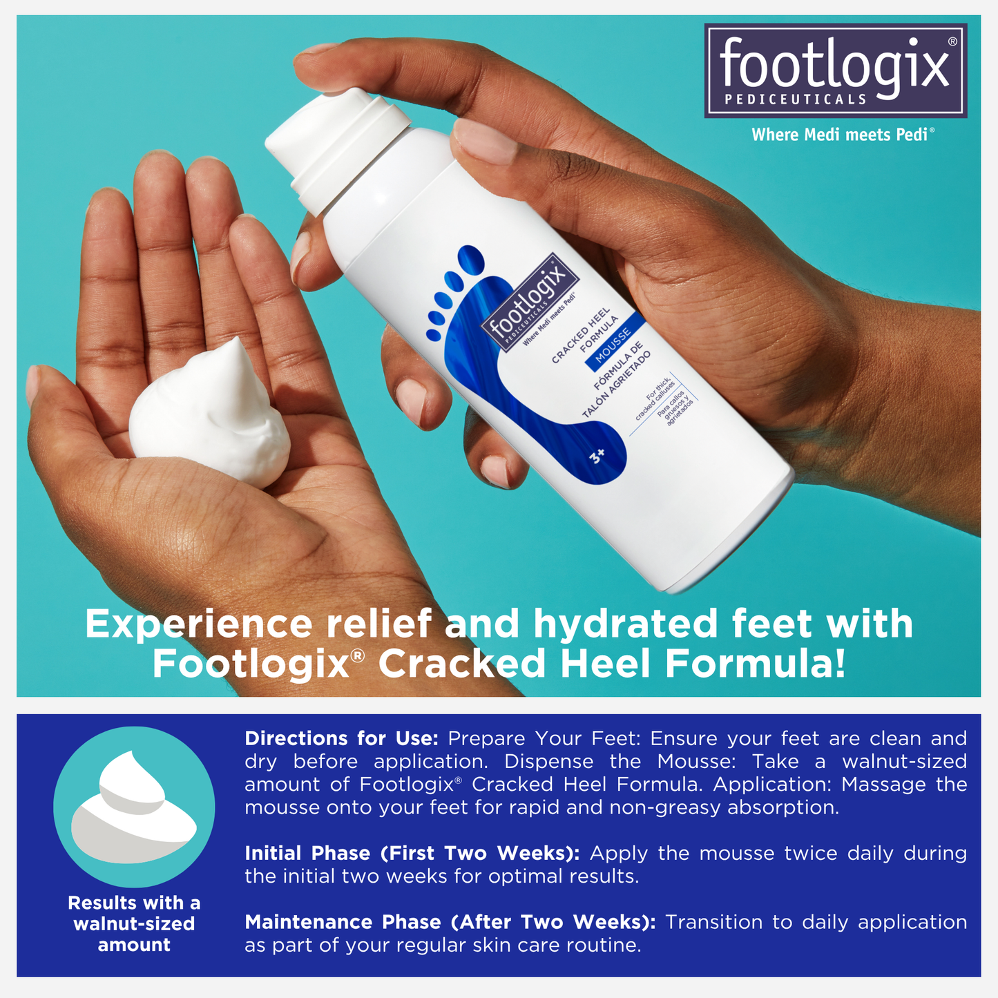 Hands holding Footlogix Cracked Heel Formula Mousse with a walnut-sized amount dispensed. Includes usage instructions: apply twice daily for two weeks, then continue as part of regular foot care routine.