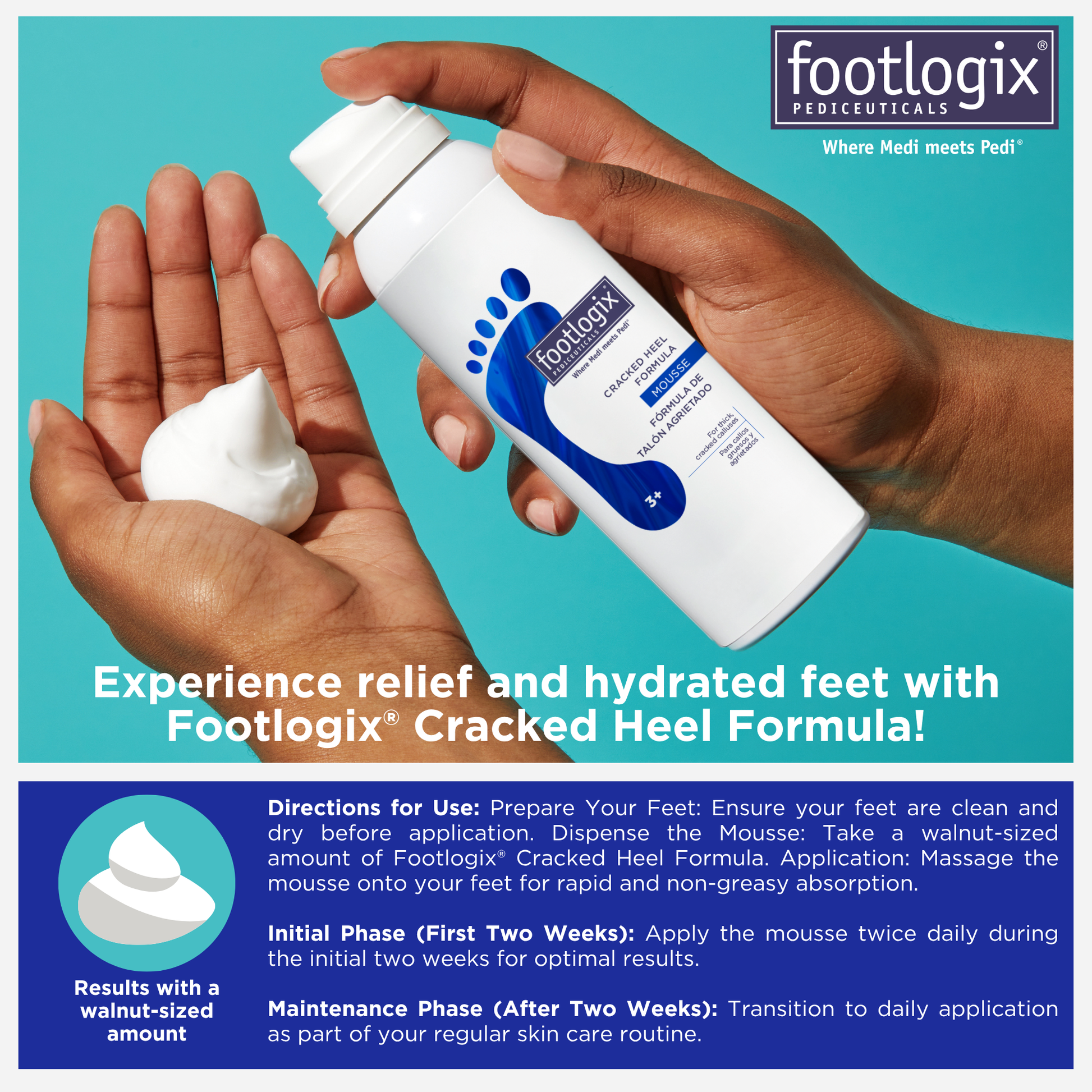 Hands holding Footlogix Cracked Heel Formula Mousse with a walnut-sized amount dispensed. Includes usage instructions: apply twice daily for two weeks, then continue as part of regular foot care routine.