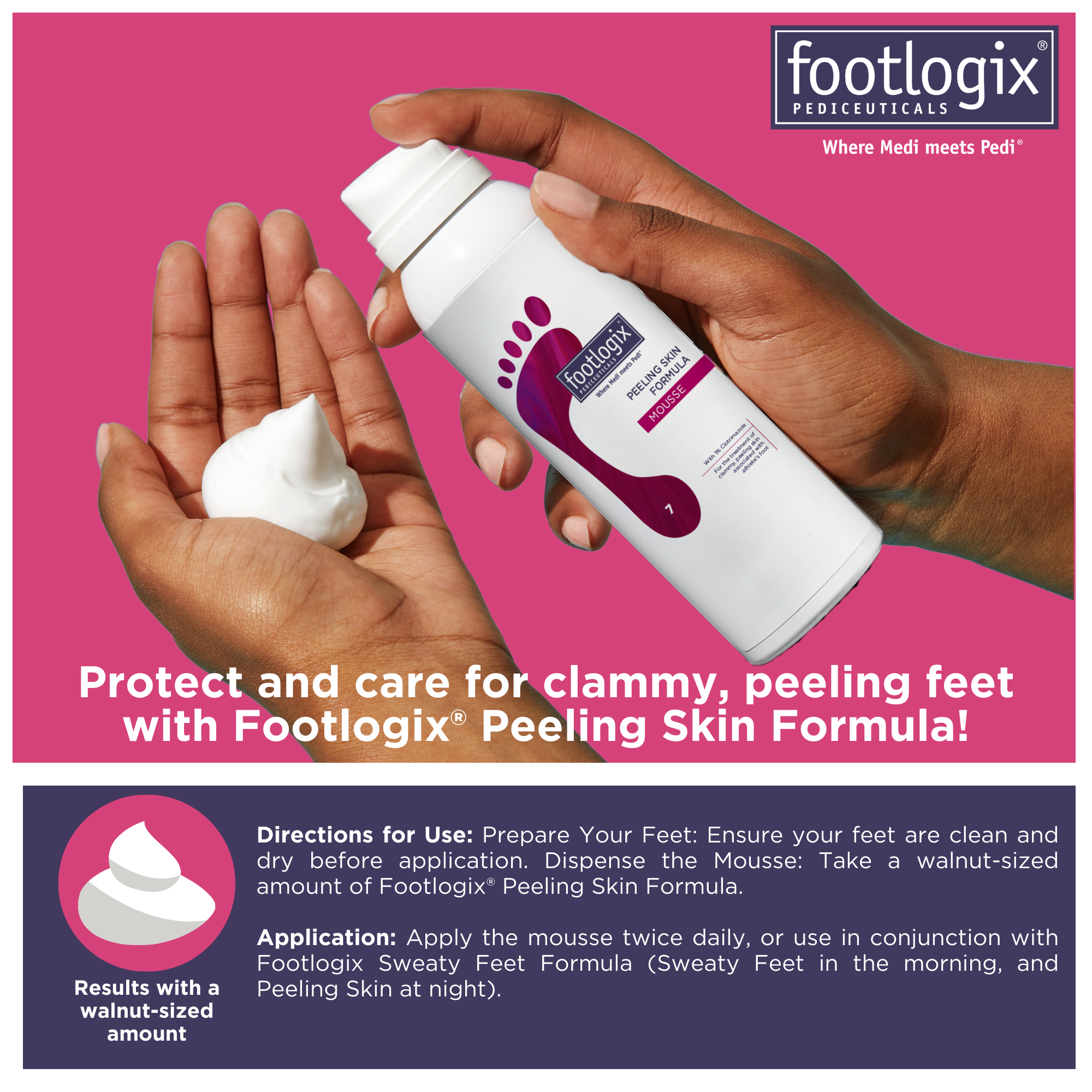 Footlogix Peeling Skin Formula