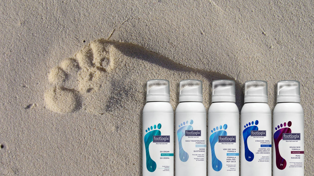 5 Annoying Things Only People with Dry, Flaky Feet Will Understand—And How to Fix Them!