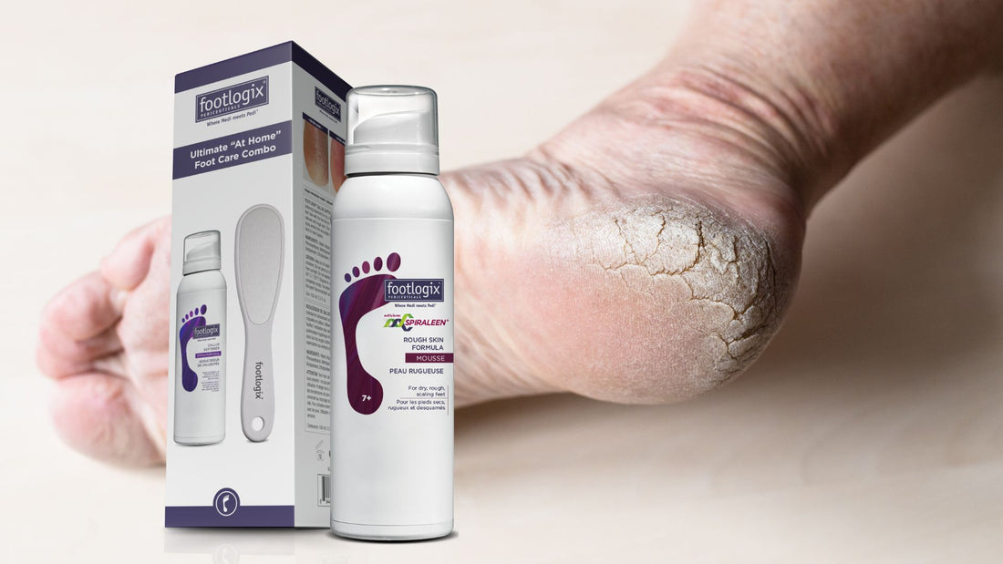 Say Goodbye to Rough Skin with the Rough Skin Rescue Kit