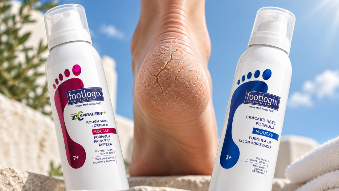 What Causes Cracked Heels, and What Can You Do About Them?