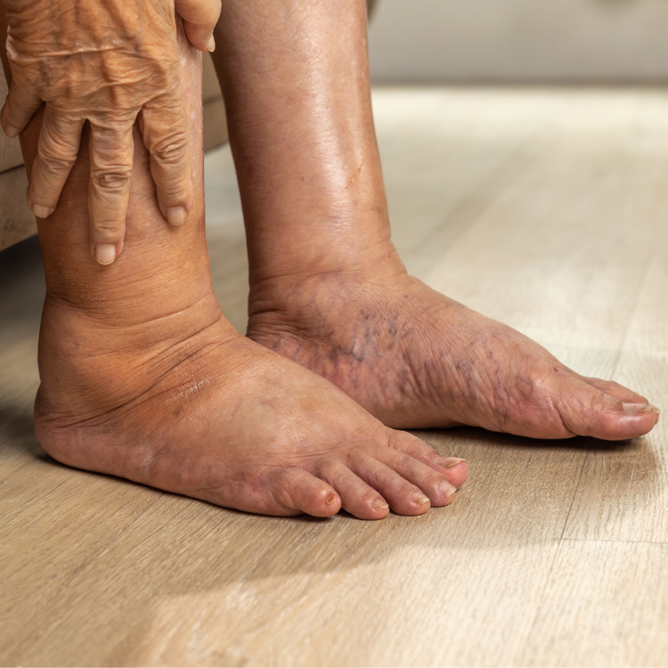 Diabetic Foot Care Solutions