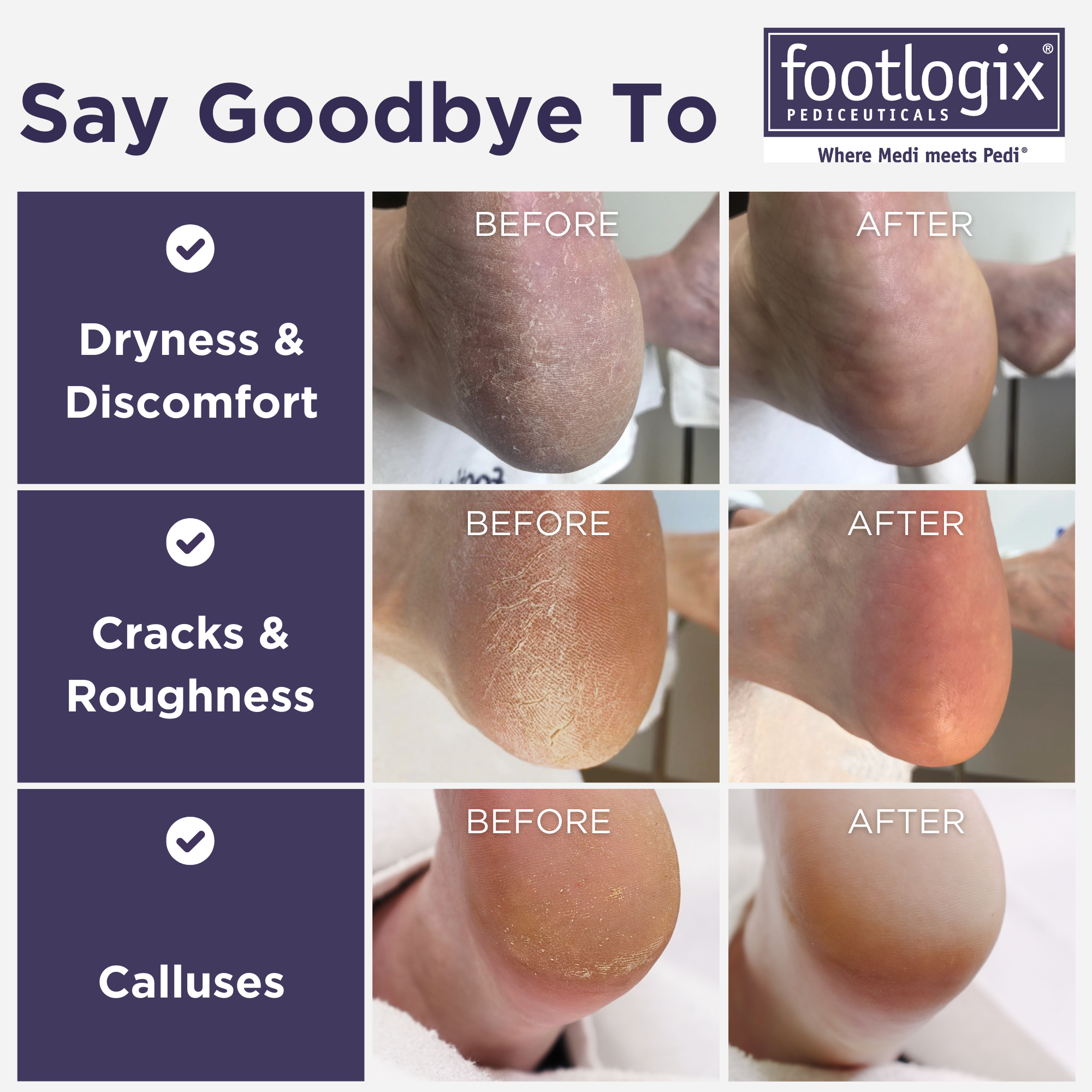 Footlogix Ultimate 