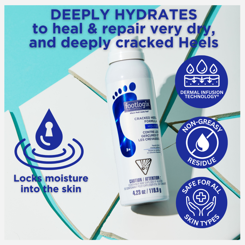 Footlogix Cracked Heel Formula Mousse canister on tile background with icons highlighting benefits: deep hydration, Dermal Infusion Technology®, non-greasy residue, locks in moisture, and safe for all skin types.