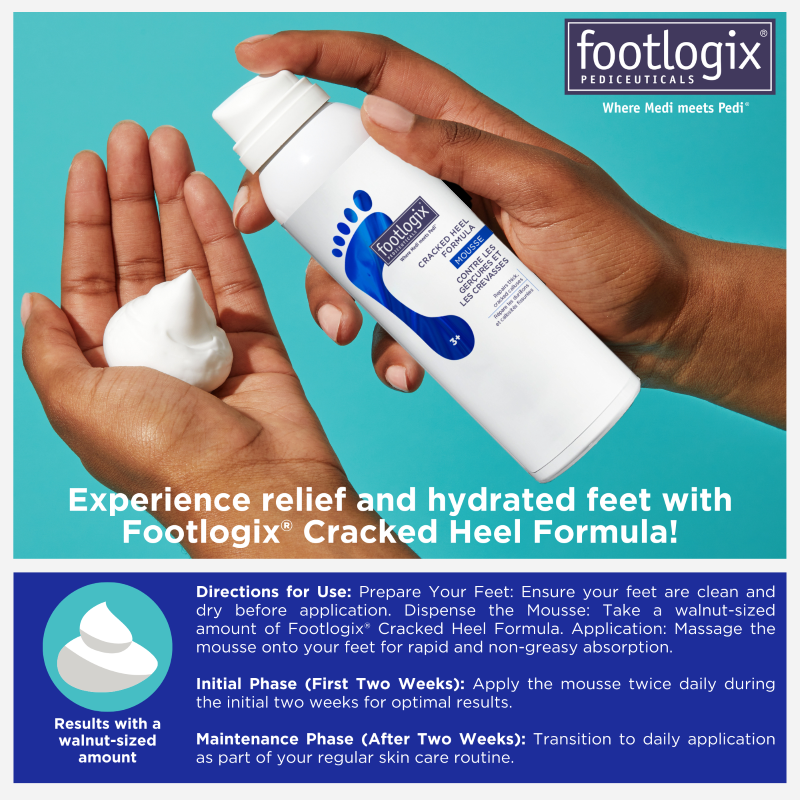Hands holding Footlogix Cracked Heel Formula Mousse with a walnut-sized amount dispensed. Includes usage instructions: apply twice daily for two weeks, then continue as part of regular foot care routine.