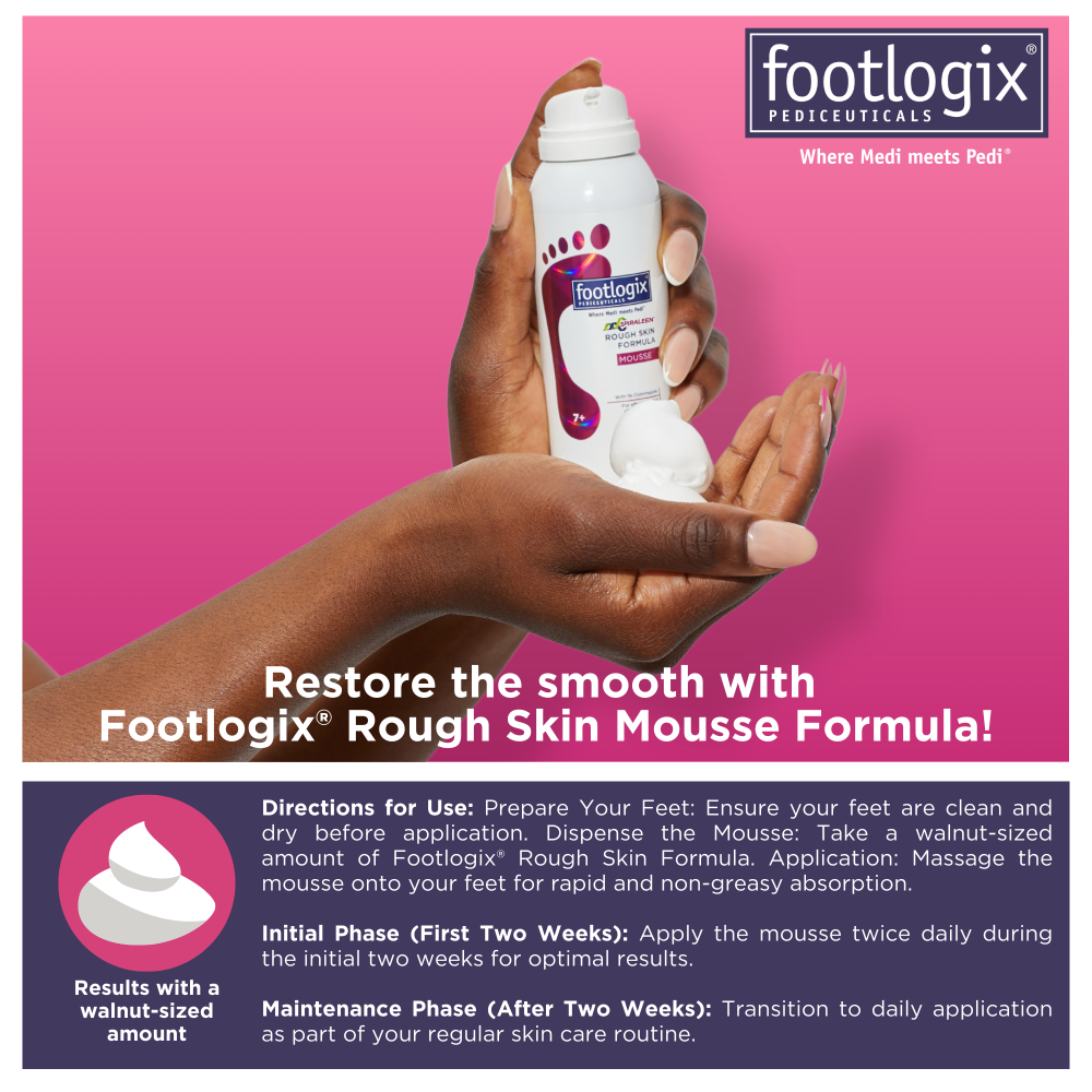 Hands holding Footlogix Rough Skin Formula with mousse dispensed. Includes usage instructions: apply walnut-sized amount twice daily for two weeks, then maintain with daily use.

