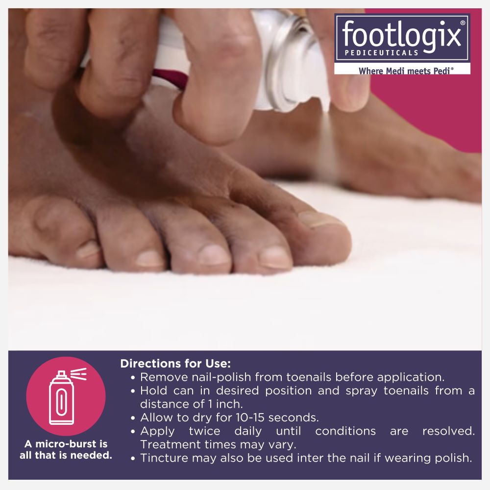 Close-up of a person spraying Footlogix Nail Tincture on toes. Includes directions: remove polish, spray from 1 inch, let dry for 10–15 seconds, apply twice daily.