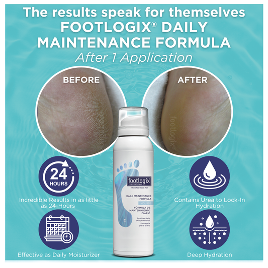Before and after close-up comparison of a heel showing visibly dry, rough skin on the left and smooth, hydrated skin after one application of Footlogix® Daily Maintenance Formula Mousse on the right. Text highlights 24-hour results, deep hydration, and Urea for moisture lock-in.