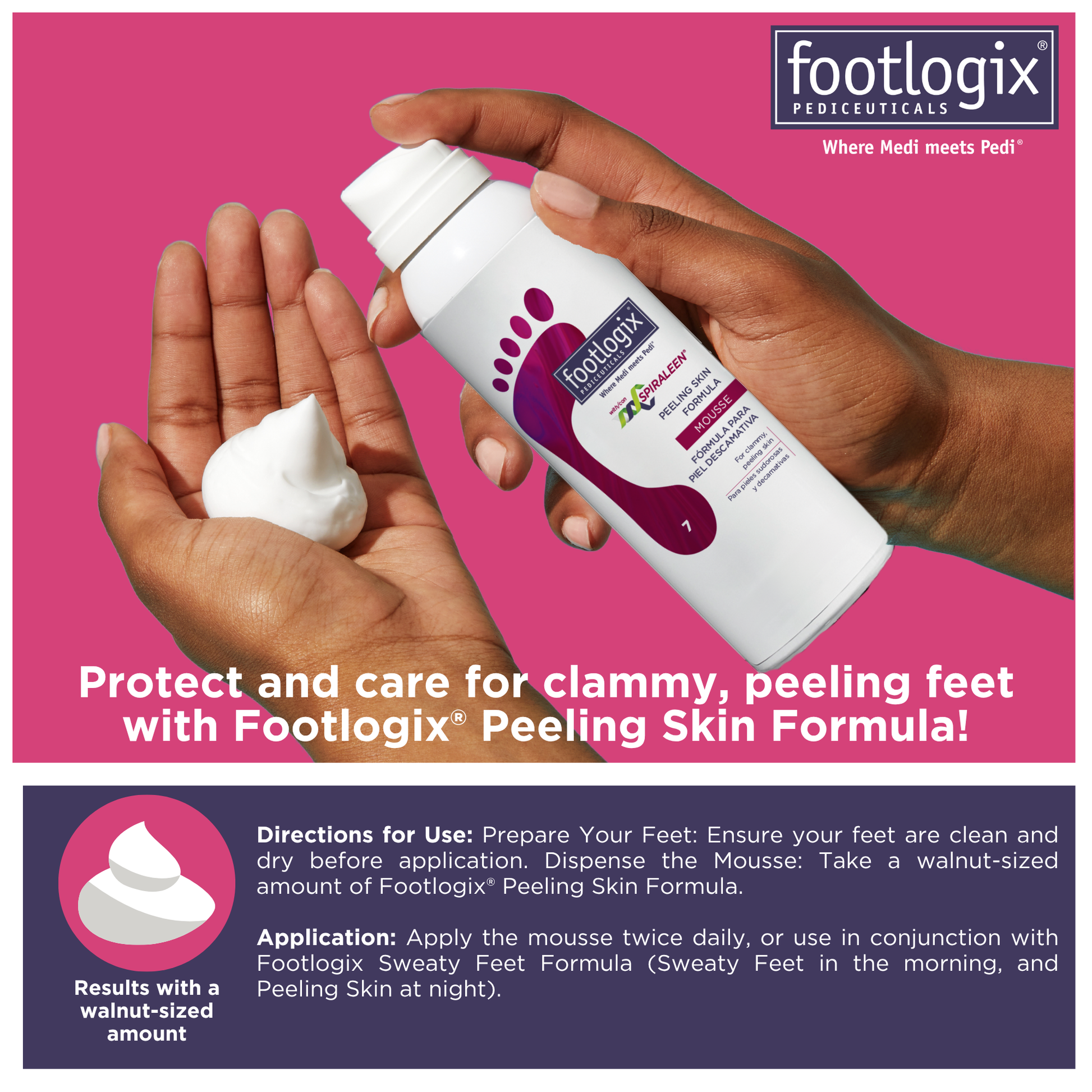 Hands dispensing walnut-sized amount of Footlogix Peeling Skin Formula Mousse. Instructions explain application and optional use with Sweaty Feet Formula.