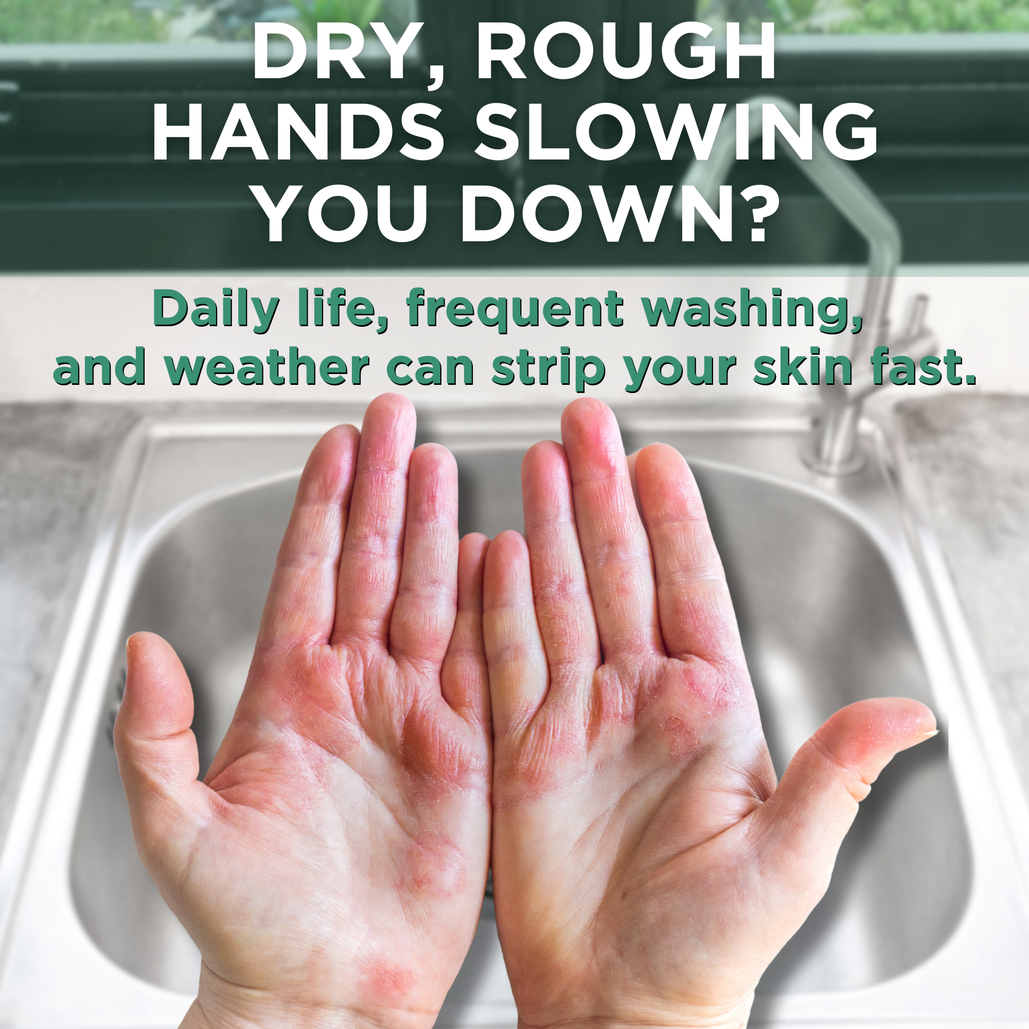 Close-up of two dry, red, rough hands held up over a kitchen sink. Text overlay reads 'Dry, Rough Hands Slowing You Down? Daily life, frequent washing, and weather can strip your skin fast.' Greenery is visible through a window in the background.