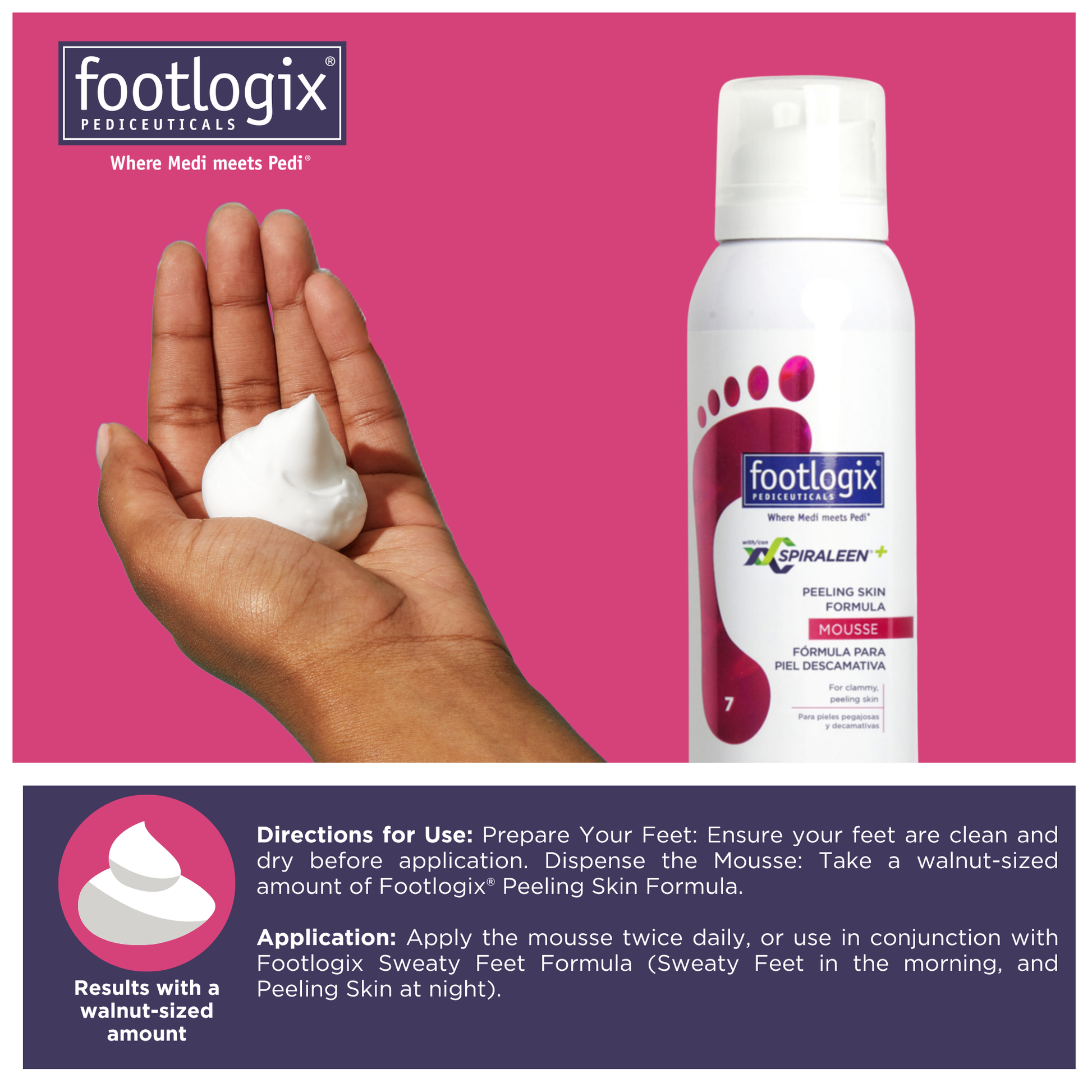 Hands dispensing Footlogix Peeling Skin Formula mousse showing walnut-sized amount and usage instructions.