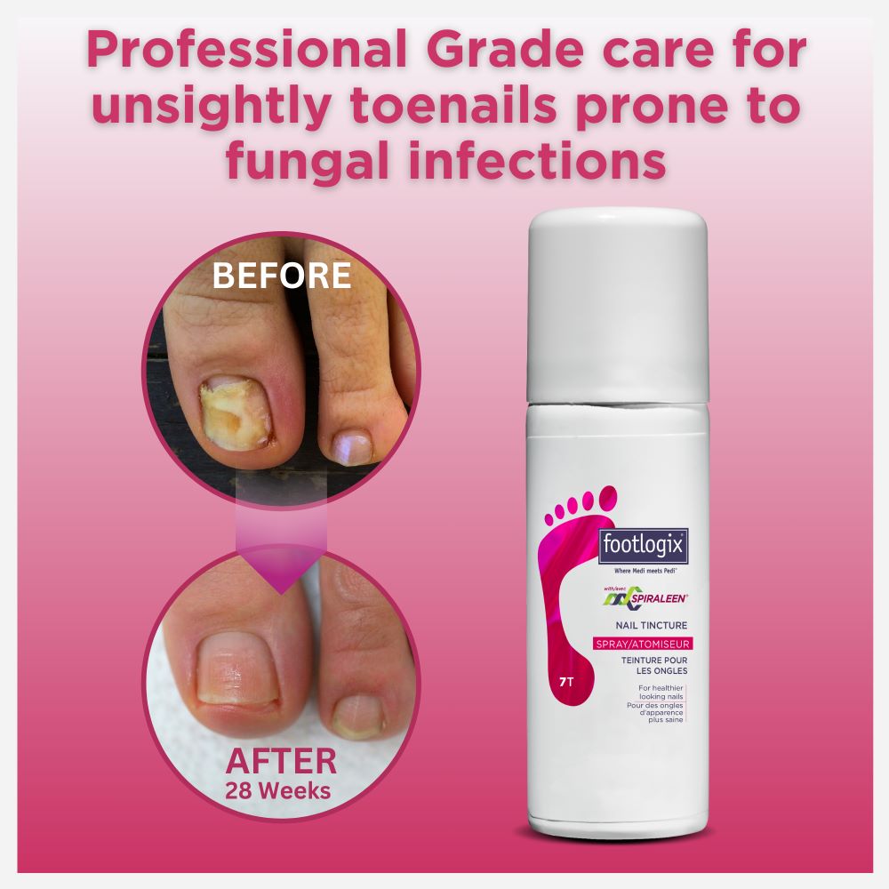 Footlogix Nail Tincture Spray