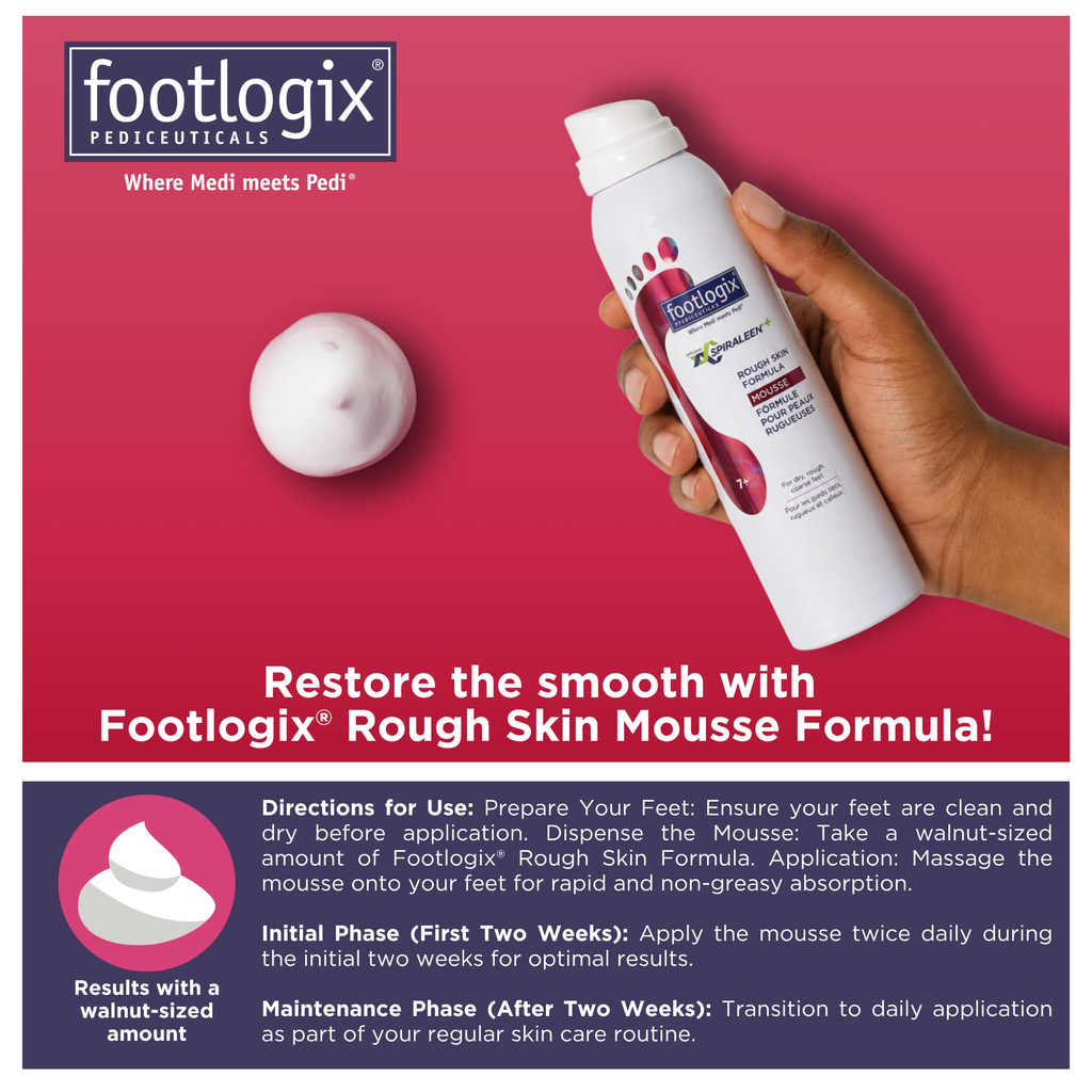 Hand holding Footlogix Rough Skin Formula mousse showing application and daily foot care routine use