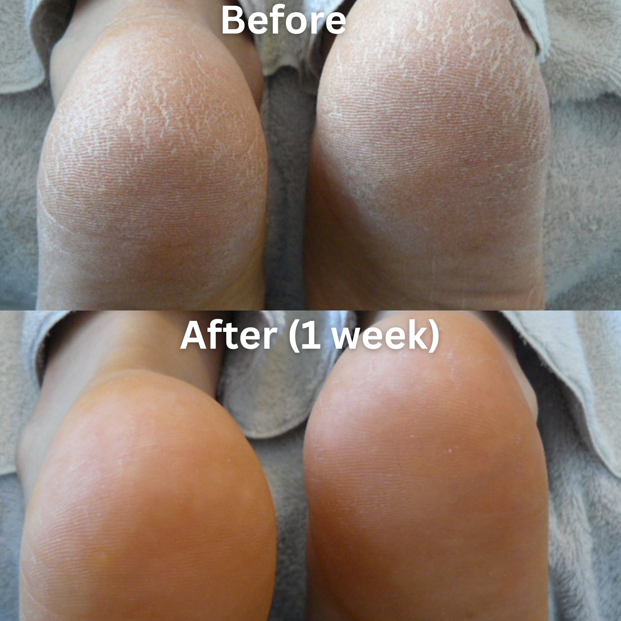 Footlogix Very Dry Skin Formula